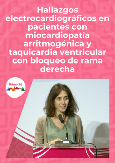 Hallazgos electrocardiográficos en pacientes con miocardiopatía arritmogénica y taquicardia ventricular con bloqueo de rama derecha