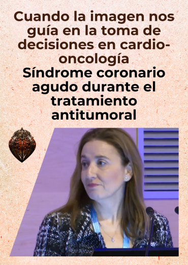 Cuando la imagen nos guía en la toma de decisiones en cardio-oncología - Síndrome coronario agudo durante el tratamiento antitumoral