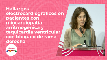 Hallazgos electrocardiográficos en pacientes con miocardiopatía arritmogénica y taquicardia ventricular con bloqueo de rama derecha