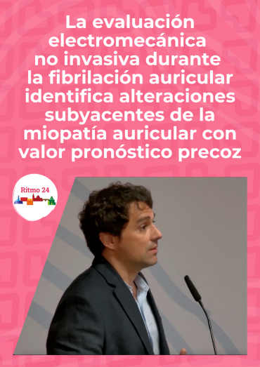 La evaluación electromecánica no invasiva durante la fibrilación auricular identifica alteraciones subyacentes de la miopatía auricular con valor pronóstico precoz