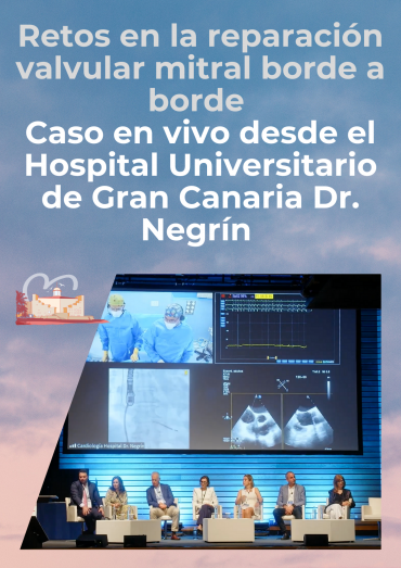 Retos en la reparación valvular mitral borde a borde - Caso en vivo desde el Hospital Universitario de Gran Canaria Dr. Negrín