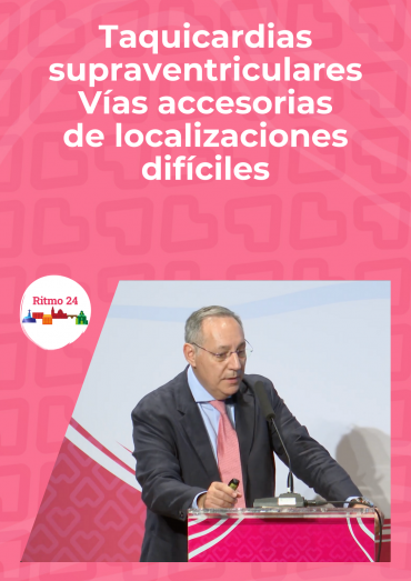 Taquicardias supraventriculares - Vías accesorias de localizaciones difíciles