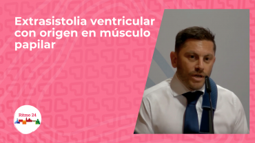 Extrasistolia ventricular con origen en músculo papilar