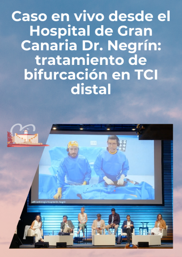 Caso en vivo desde el Hospital Dr. Negrín: tratamiento de bifurcación en TCI distal