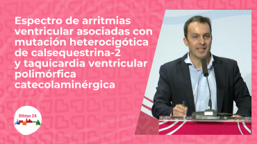 Espectro de arritmias ventricular asociadas con mutación heterocigótica de calsequestrina-2 y taquicardia ventricular polimórfica catecolaminérgica