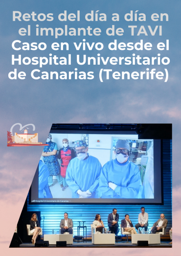 Retos del día a día en el implante de TAVI - Caso en vivo desde el Hospital Universitario de Canarias (Tenerife)