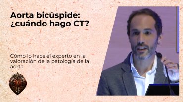 Aorta bicúspide: ¿cuándo hago CT?