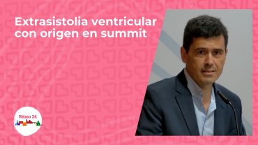 Extrasistolia ventricular con origen en summit