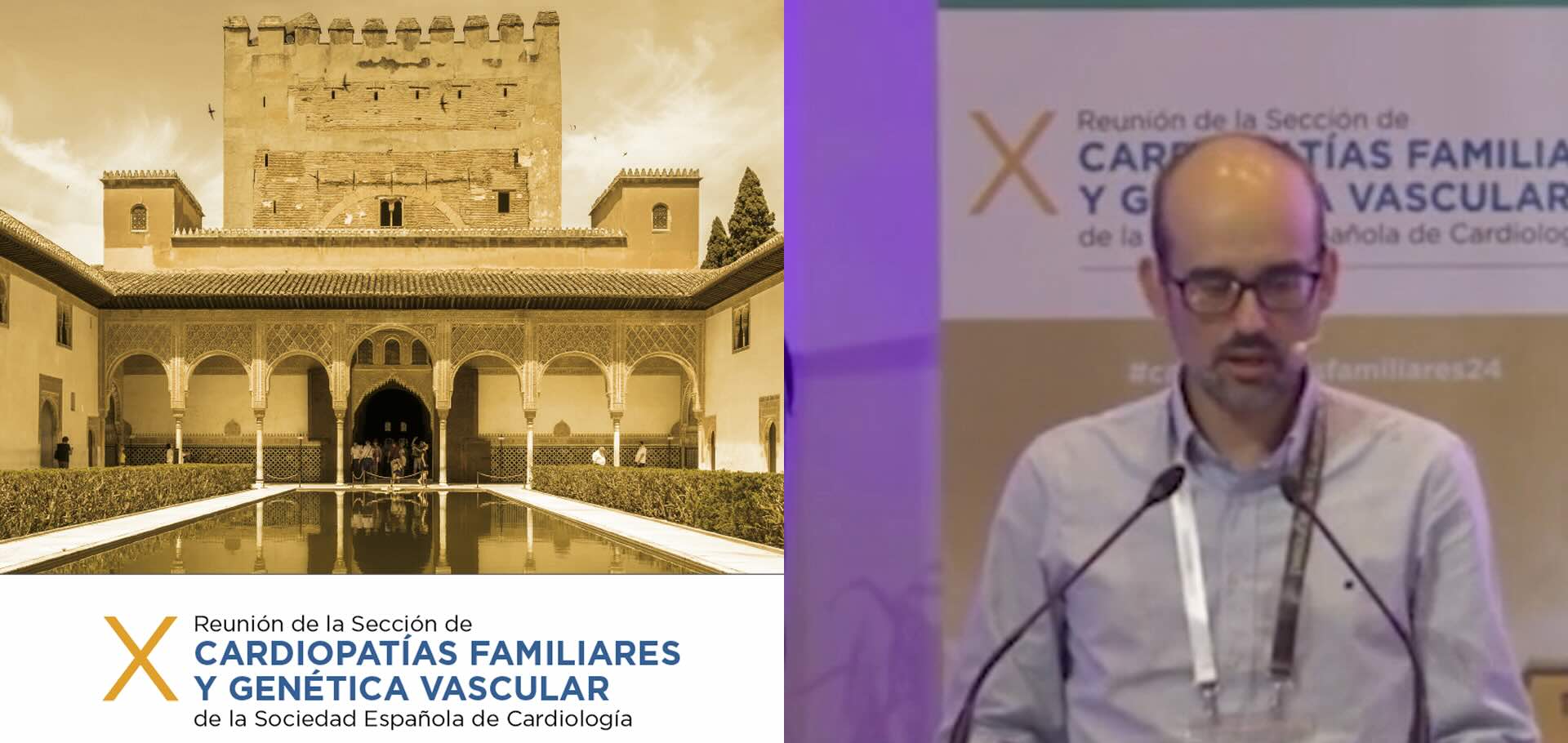 Amiloidosis cardiaca