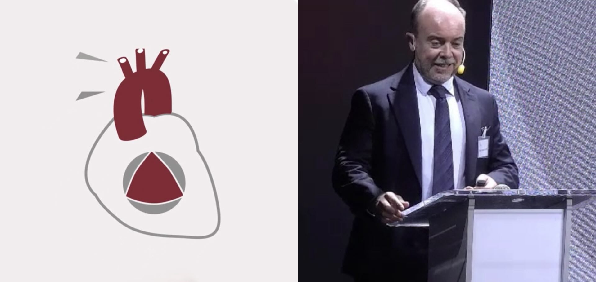 Cuándo tratar la insuficiencia mitral con cirugía