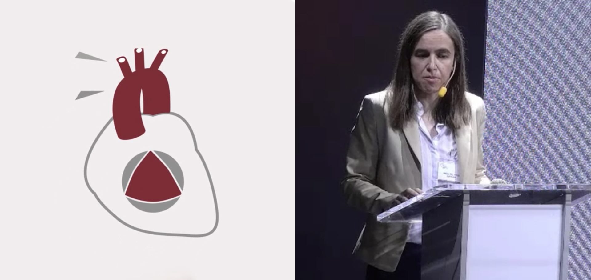 Cuándo tratar la insuficiencia mitral mediante técnicas transcatéter