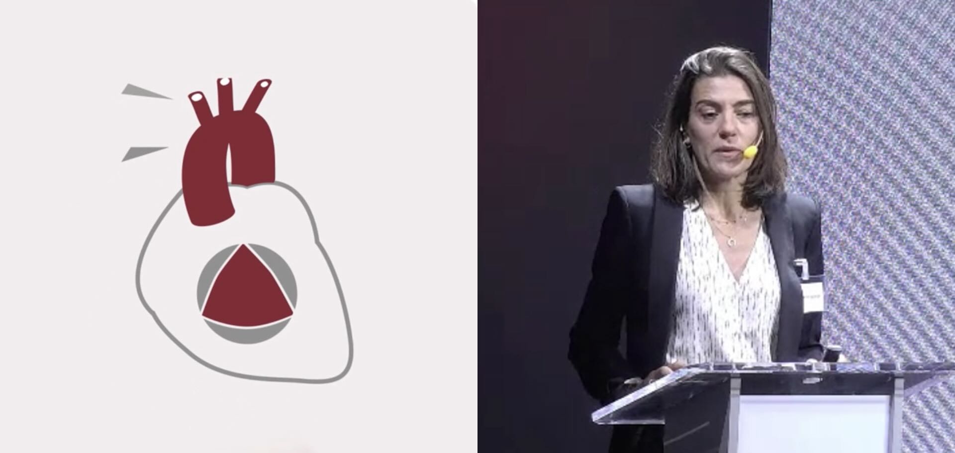 Caso clínico: endocarditis valvular mitral y aórtica nativa