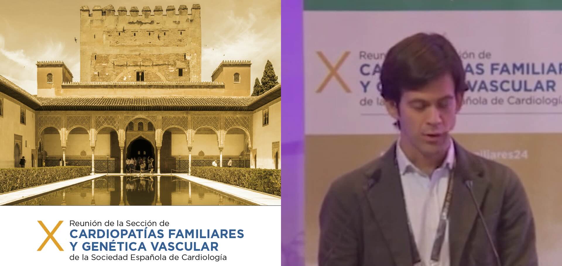 Fibrilina-2 y aortopatía familiar. ¿Más allá  del síndrome de Beal?