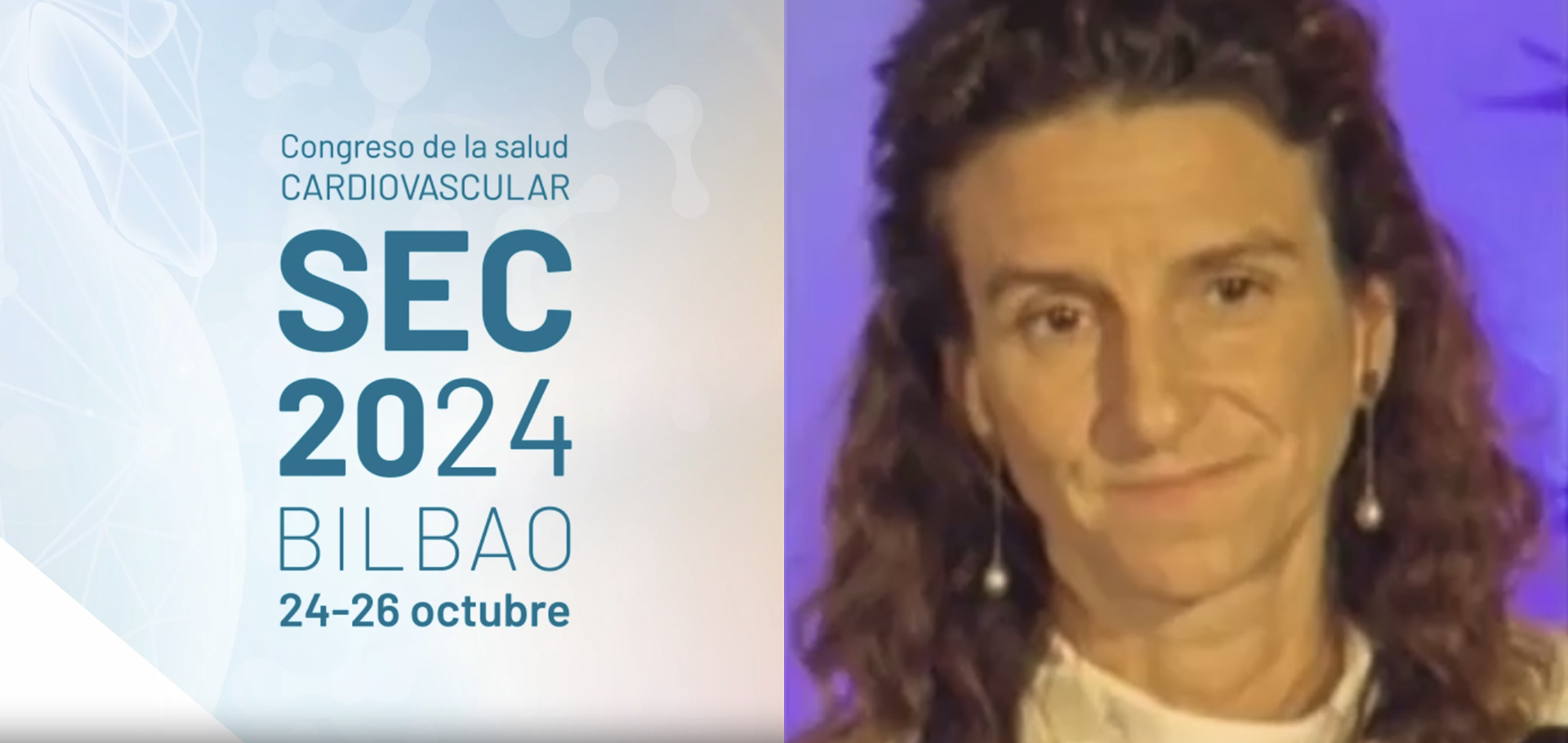 La investigación cardiovascular en la mujer 2024: estudio WAKE UP