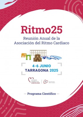 Ritmo 25 