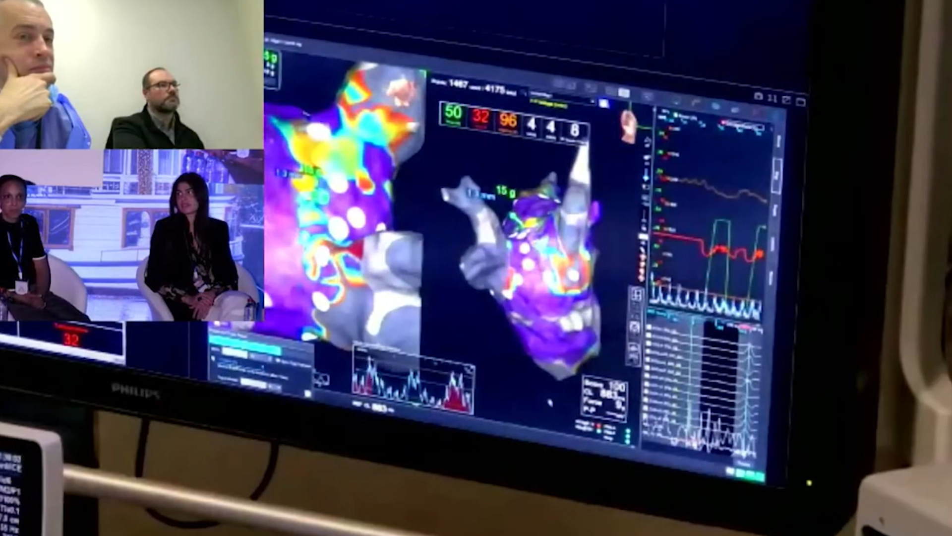 Caso clínico en vivo: ablación de fibrilación auricular con Volt PFA y navegación asistida en remoto